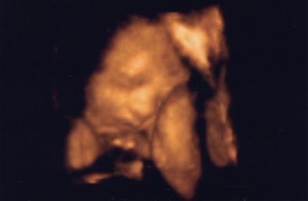 Le visage de notre petit ange